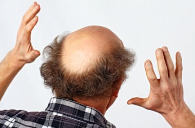 男女で異なる脱毛の原因と症状、改善方法は？